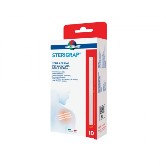 ΤΑΙΝΙΑ ΣΥΓΚΛΙΣΗΣ ΤΡΑΥΜΑΤΩΝ STERIGRAP 6X100MM 10τμχ Master-Aid ΤΑΙΝΙΑ ΣΥΓΚΛΙΣΗΣ ΤΡΑΥΜΑΤΩΝ STERIGRAP 6X100MM 10τμχ Master-Aid