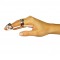 ΜΕΤΑΛΛΙΚΟΣ ΝΑΡΘΗΚΑΣ ΔΑΚΤΥΛΟΥ "BASEBALL SPLINT" 03-2-012/331 Vita Orthopaedics